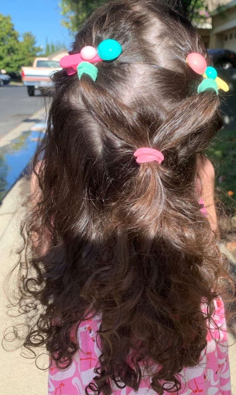 Customer photo review of Playful Hair Clips (Set of 5)