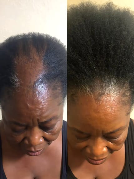 Customer photo review of Velura™ Crown Revival Capsules