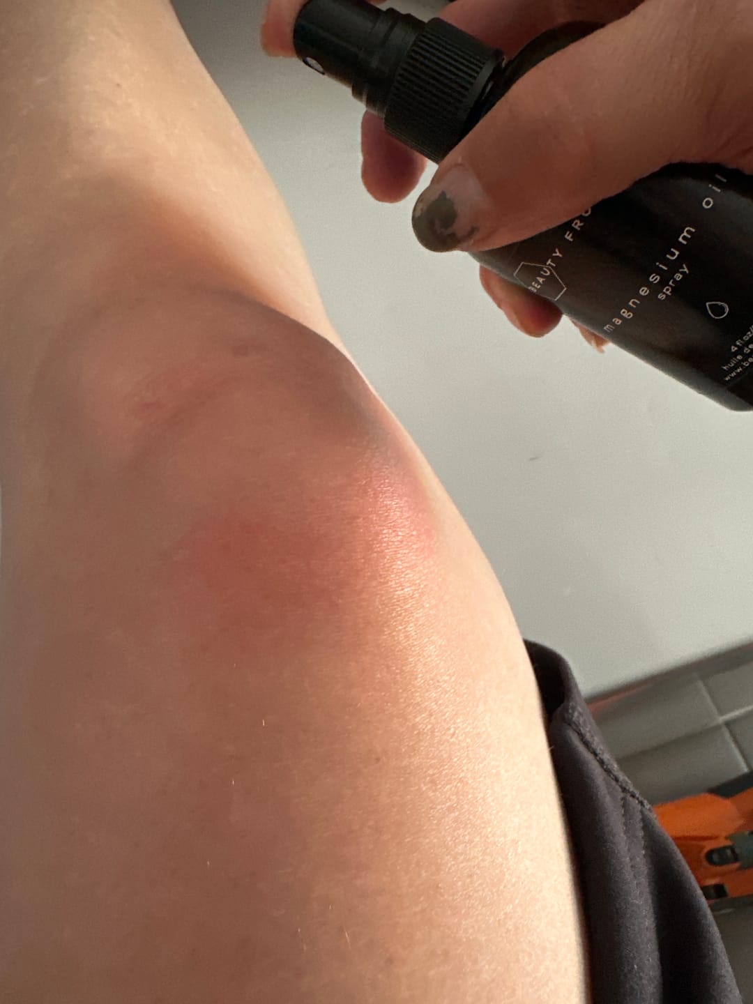 Customer photo review of Magnesium Oil