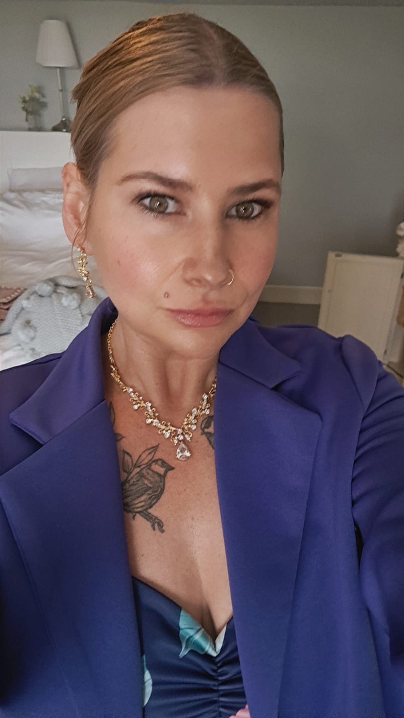 Customer photo review of Rosalique 3 in 1 Anti-Redness Miracle Formula SPF50