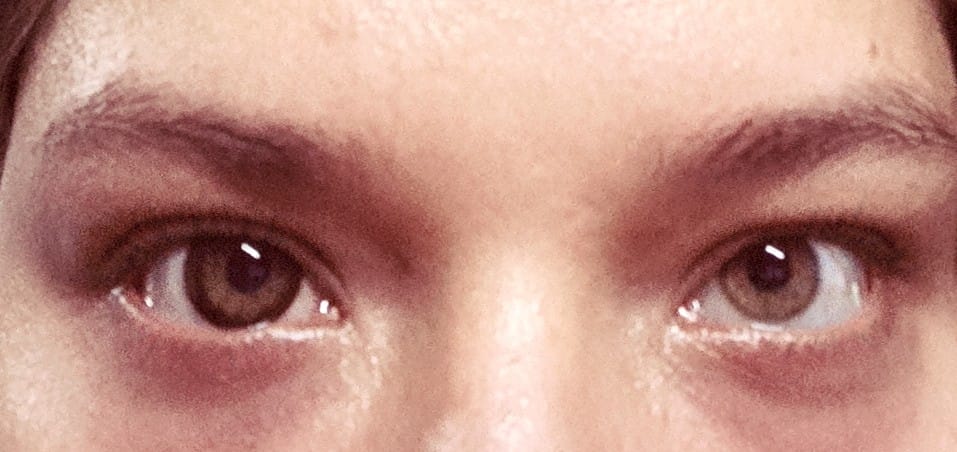 Customer photo review of Big Eyes Chocolate Brown Colored Contact Lenses