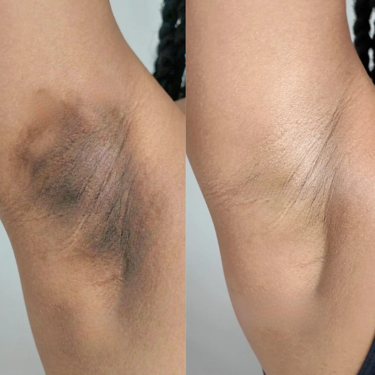 Customer photo review of Savon au curcuma Anti-Tâches - Retrouvez votre confiance
