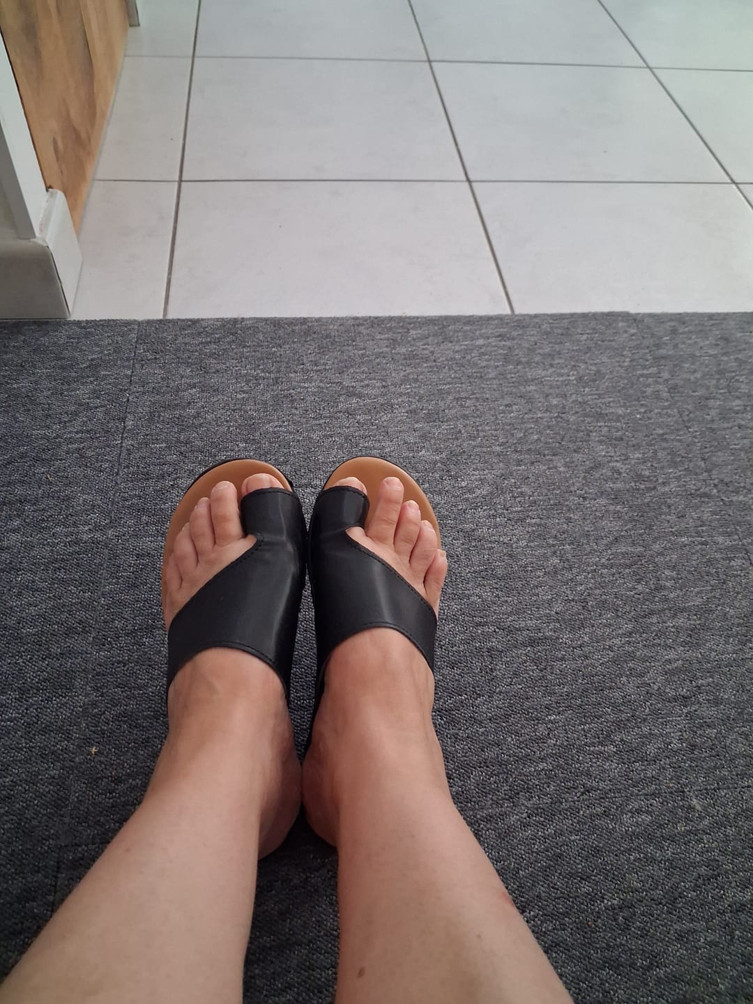 Customer photo review of Sandales Orthopédiques correctrices des Oignons - Hallux Valgus - Gros Orteil