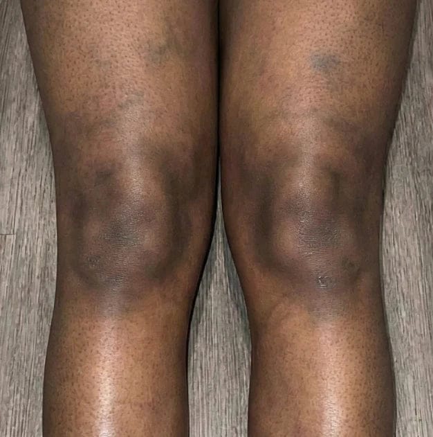 Customer photo review of Savon au curcuma Anti-Tâches - Retrouvez votre confiance