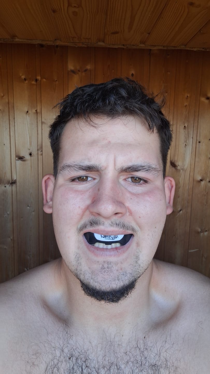Customer photo review of ImpactShield Premium Mundschutz
