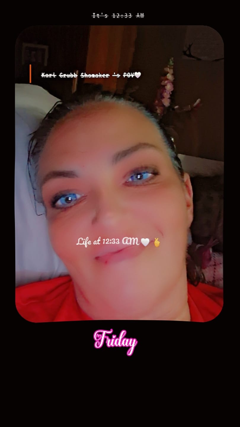 Customer photo review of Yari Blue Prescription Colored Contact Lenses