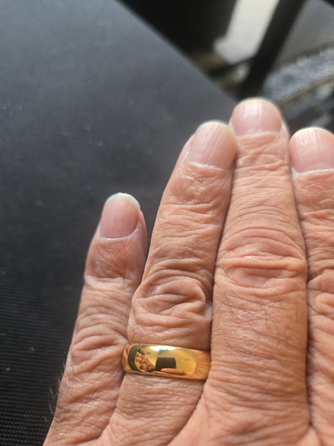 Customer photo review of Gold Wonder Ring Set