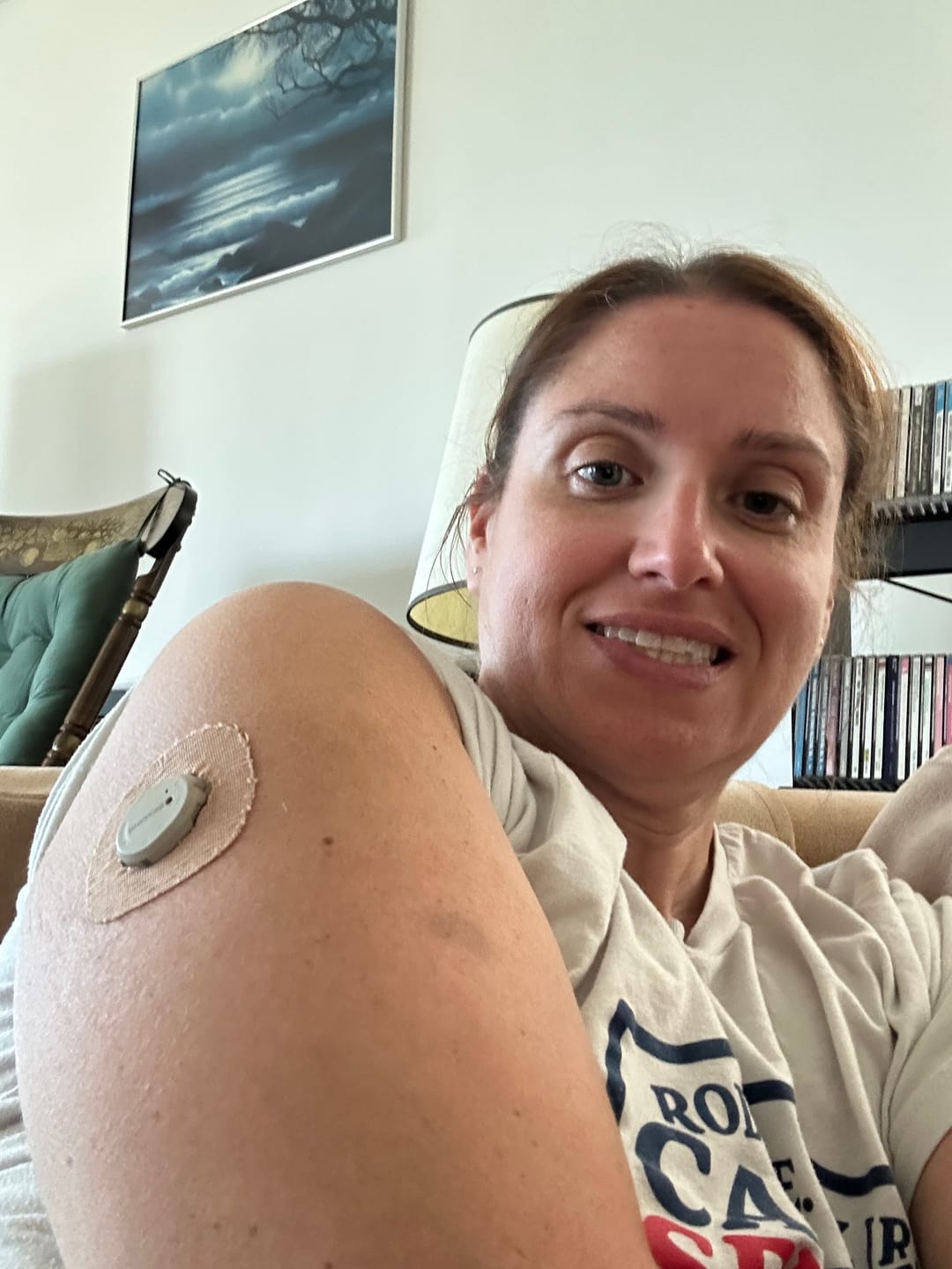 Customer photo review of Skin Grip Original - Dexcom G7 & Stelo Adhesive Patches (With Cutout)