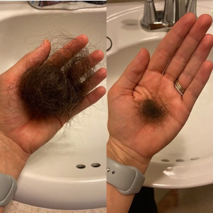 Customer photo review of ערכת צמיחת שיער מחדש