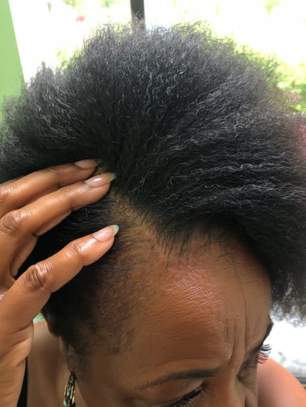 Customer photo review of Velura™ Crown Revival Capsules