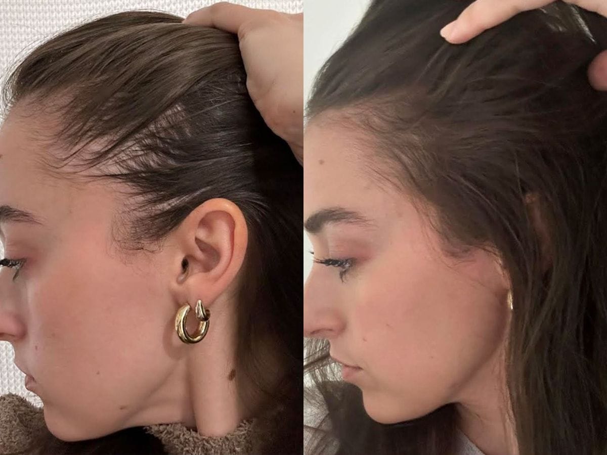 Customer photo review of ערכת צמיחת שיער מחדש