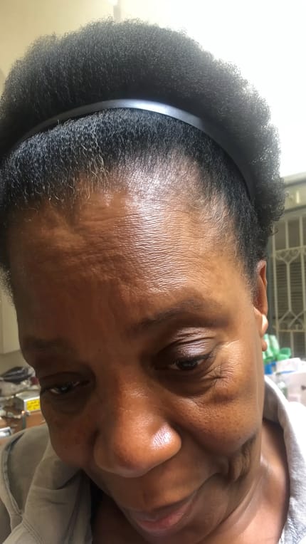 Customer photo review of Velura™ Crown Revival Capsules