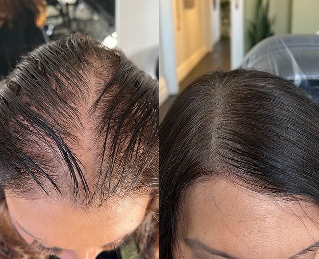 Customer photo review of ערכת צמיחת שיער מחדש