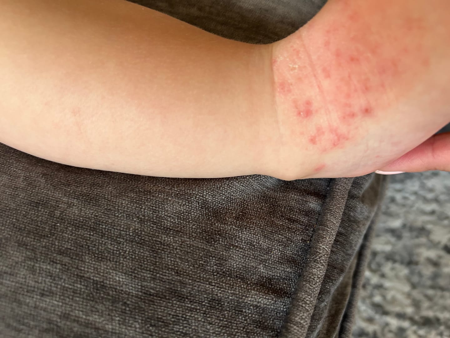 Customer photo review of Grass-Fed Tallow Body Balm | Cold Weather Protection