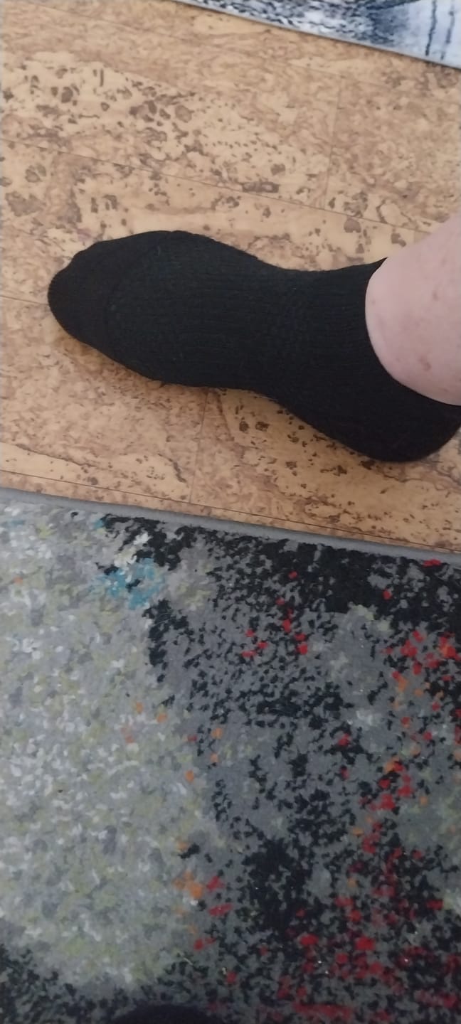 Customer photo review of Diasocks Stödstrumpor (15-20 mmHg)