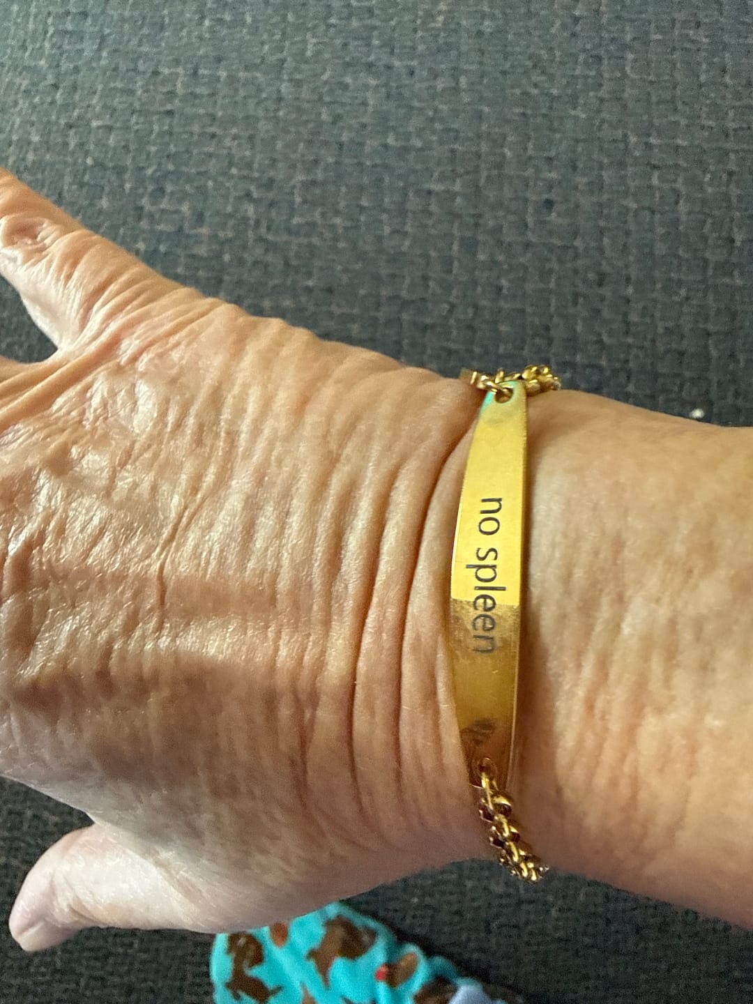 Customer photo review of Gold Colour Medical Alert Bracelet with Medical Charm