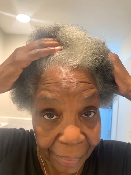 Customer photo review of Velura™ Crown Revival Capsules