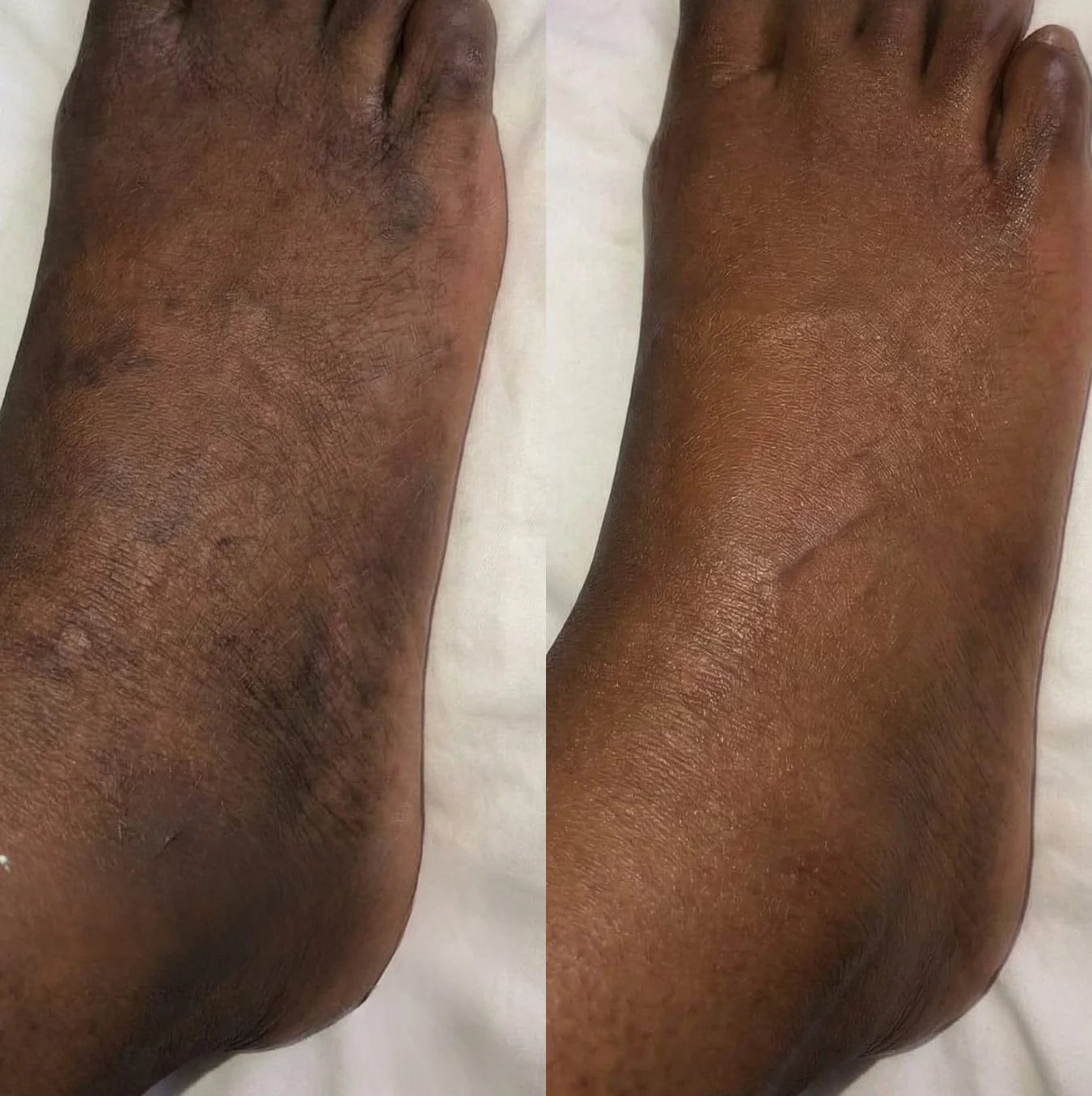 Customer photo review of Savon au curcuma Anti-Tâches - Retrouvez votre confiance