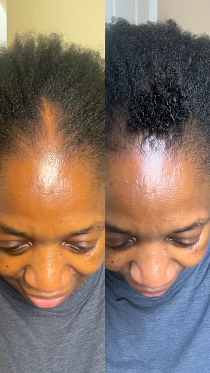 Customer photo review of Velura™ Crown Revival Capsules