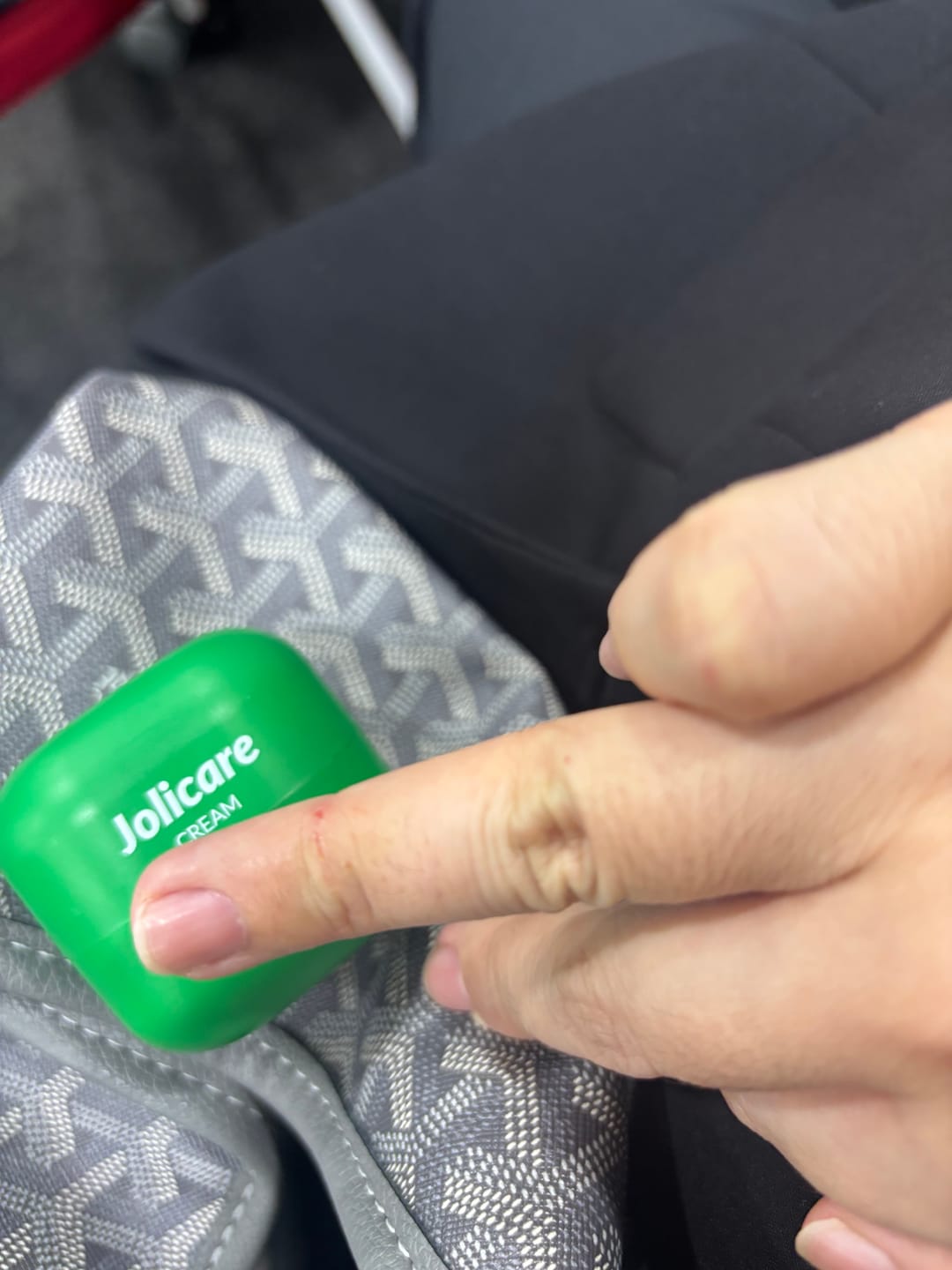 Customer photo review of Jolicare Cream