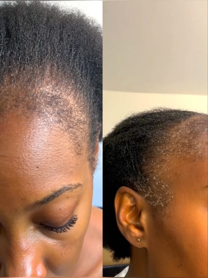 Customer photo review of Velura™ Crown Revival Capsules