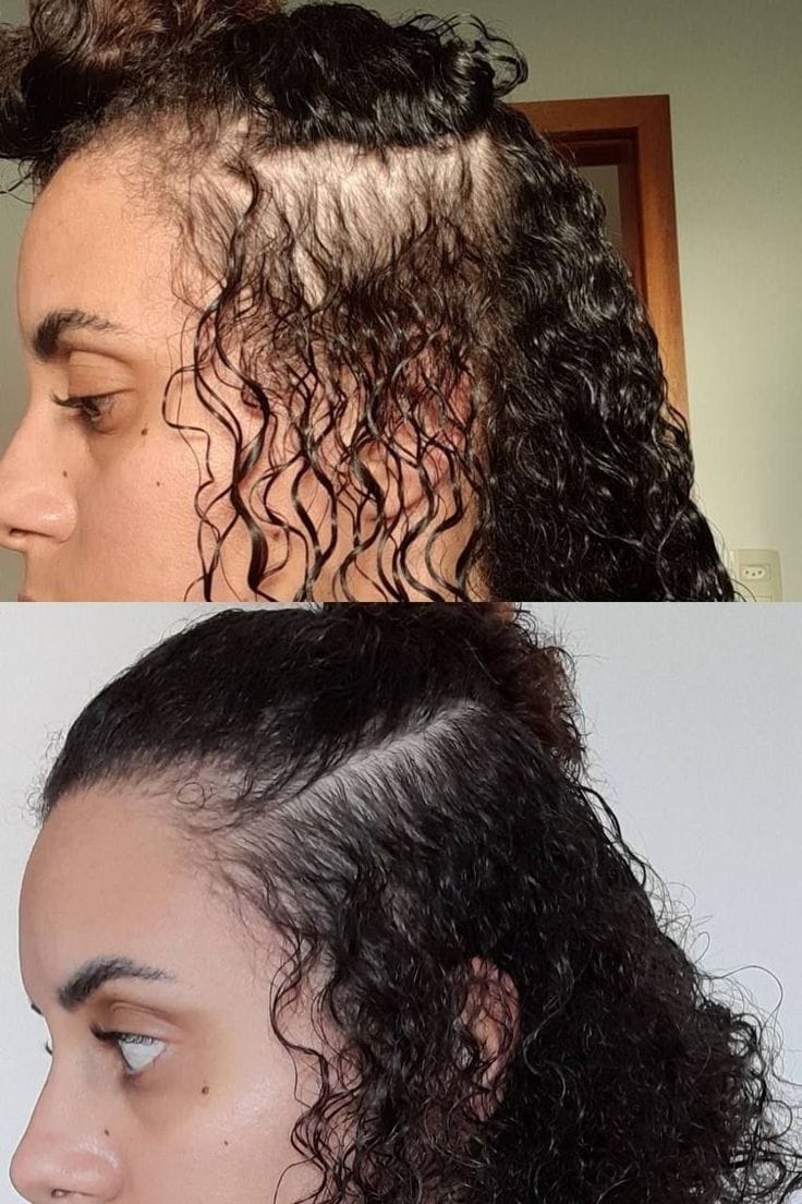Customer photo review of ערכת צמיחת שיער מחדש