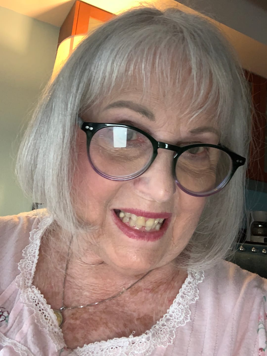 Customer photo review of Ultimate Hair Strength PRO Supplements- 30 Days