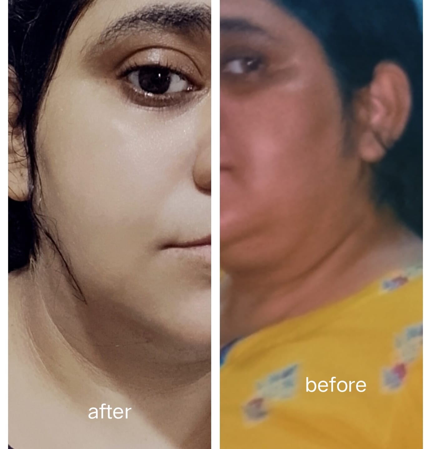 Customer photo review of Maxdif Brightening Serum