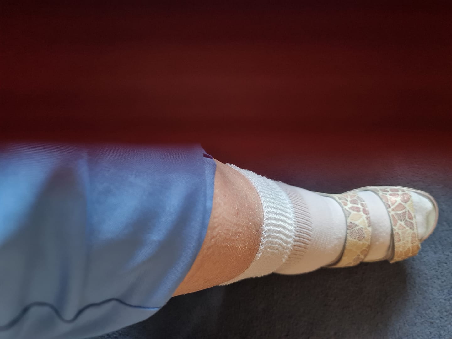 Customer photo review of EverSock™ Bamboo Ankle Compression Socks