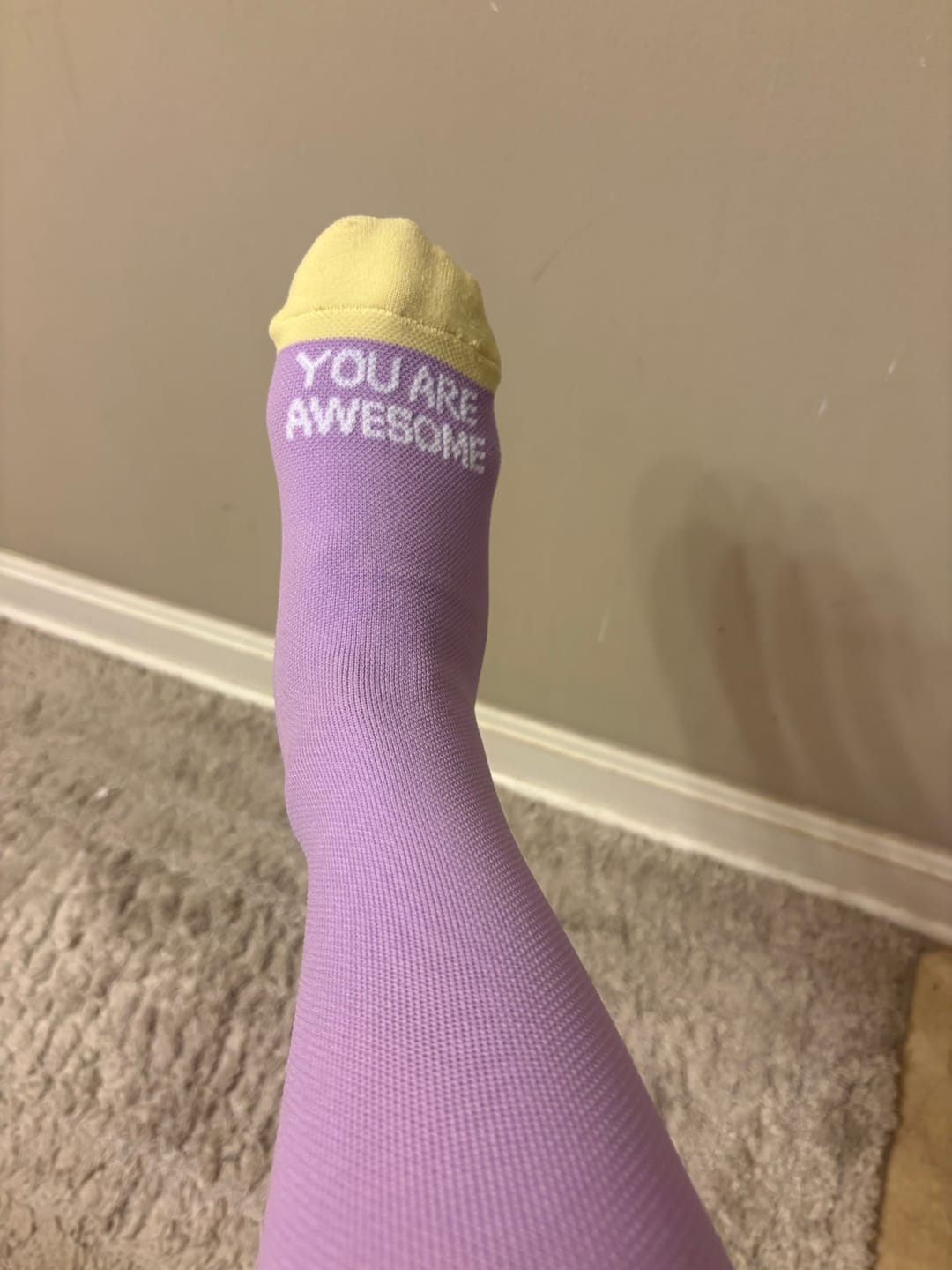 Customer photo review of NurseStrong Performance Compression Socks