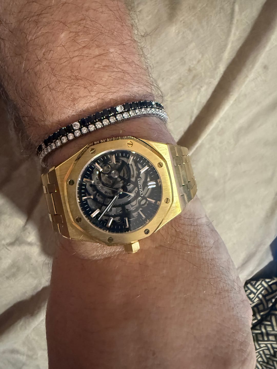 Customer photo review of 'Gold Anatomy' Royal Oak Series