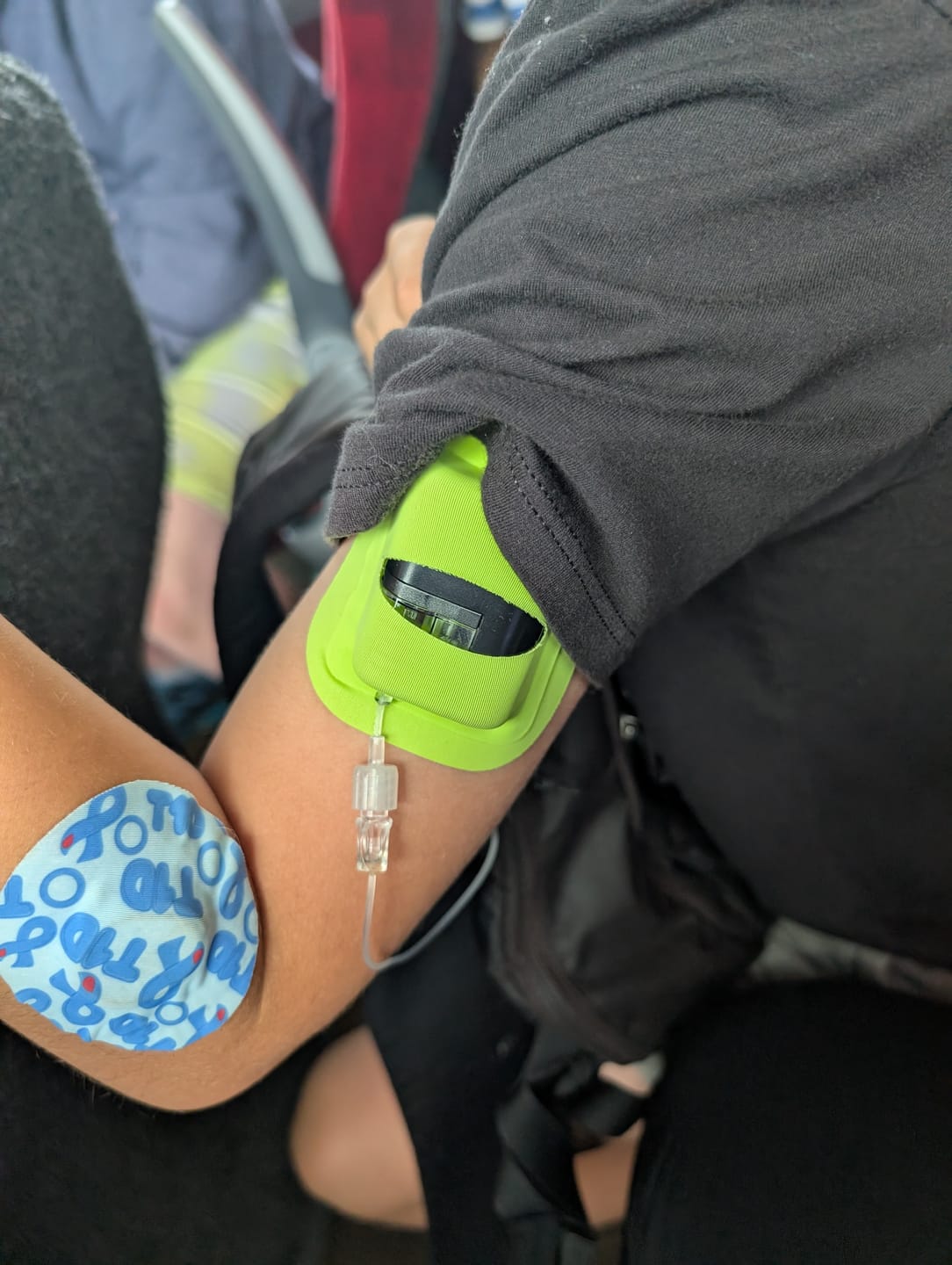 Customer photo review of Skin Grip - Tandem Mobi Pocket Patch