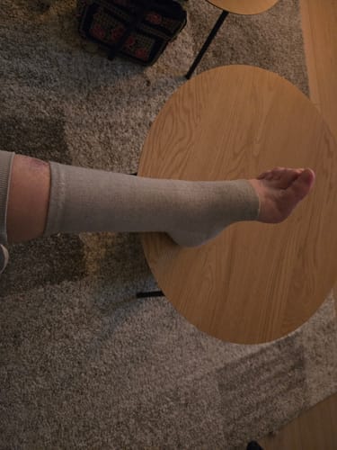 Customer photo review of Bamboe Voetsleeves - 1+1 GRATIS