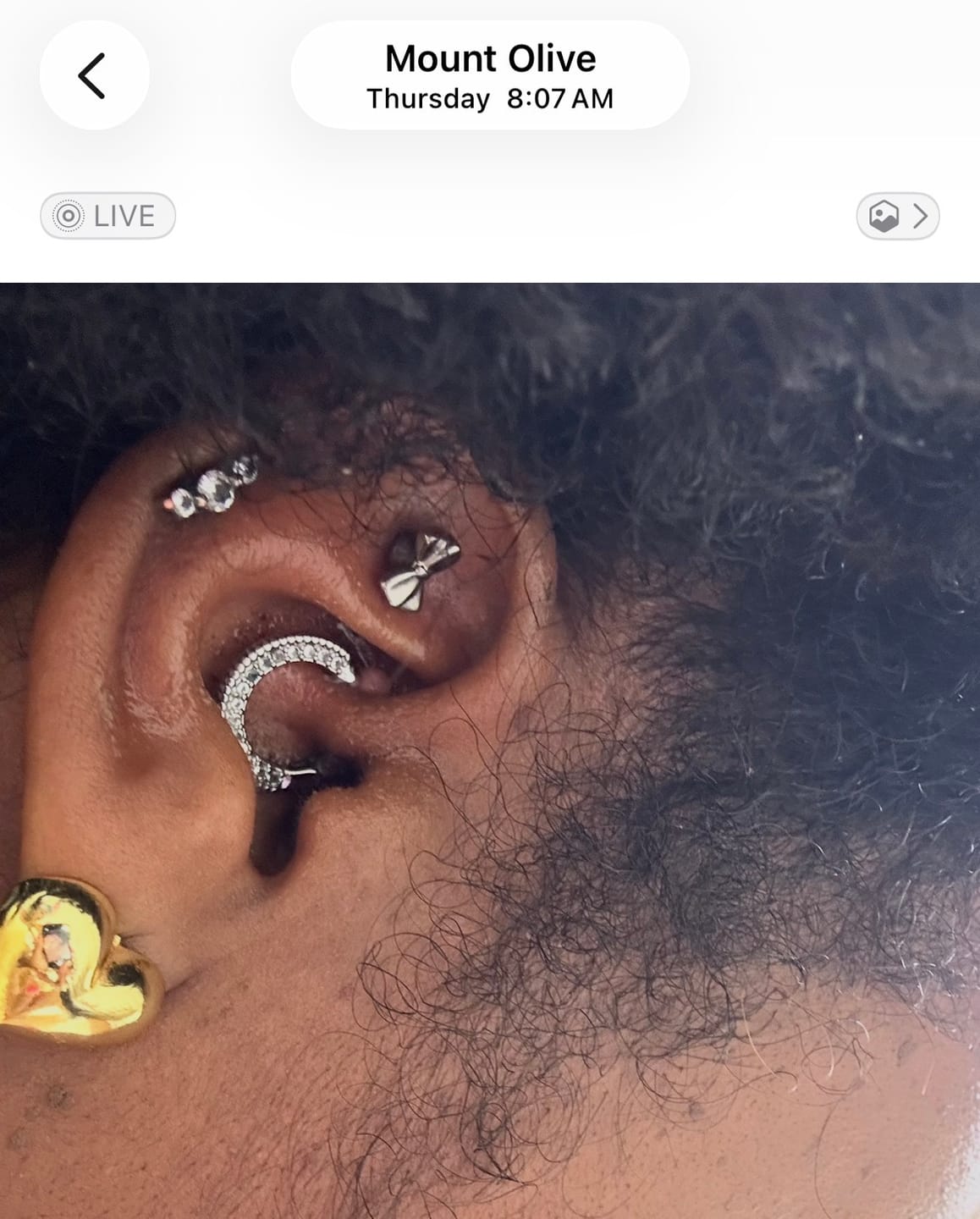 Customer photo review of Piercing Bump Emergency Trio