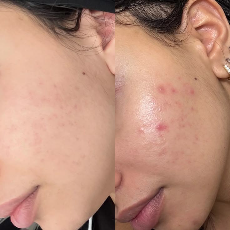Customer photo review of Instant Glow Duo