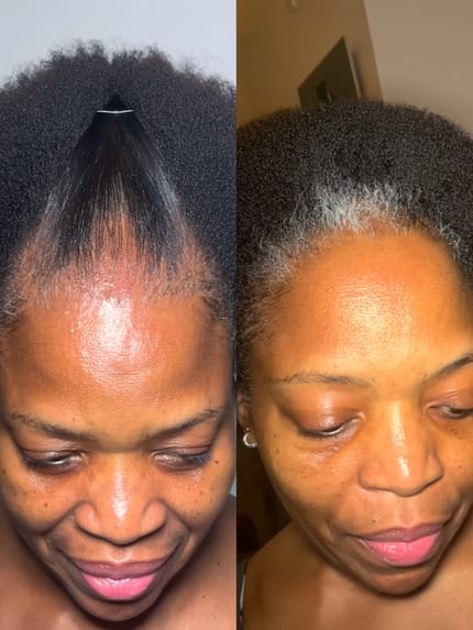 Customer photo review of Velura™ Crown Revival Capsules