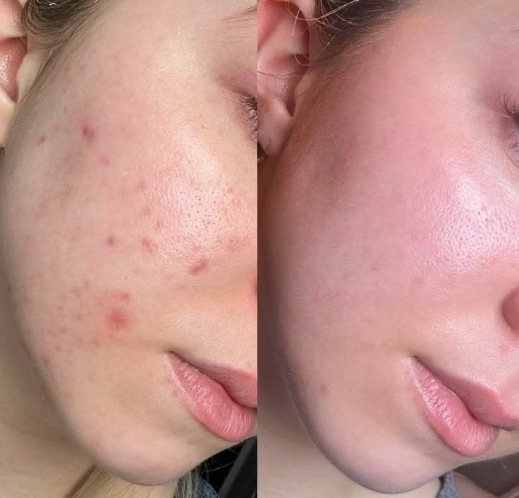 Customer photo review of Maxdif Facewash