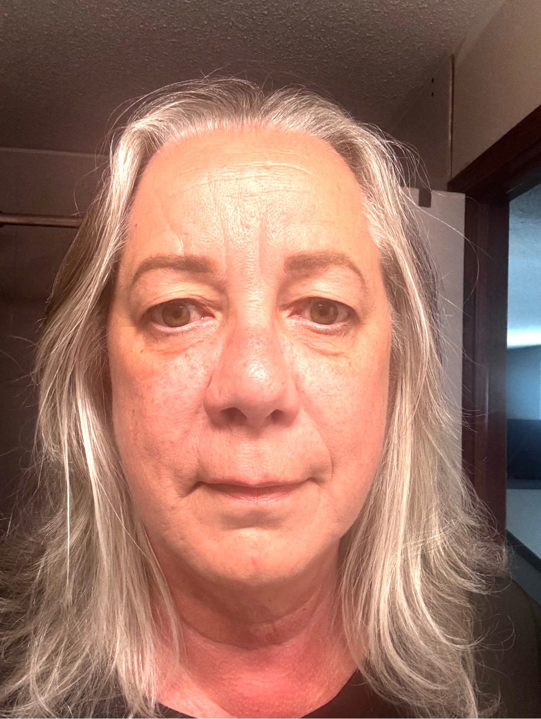 Customer photo review of F-Balm - Premium Tallow Balm