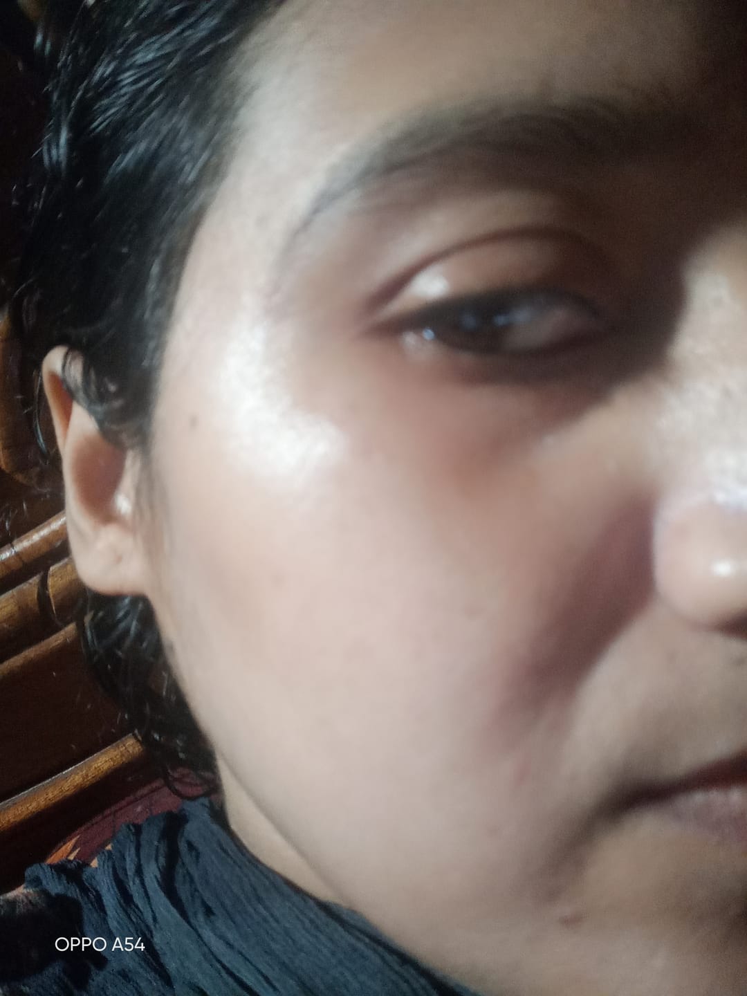 Customer photo review of Freckles Bundle - Advanced Skin Brightening & Repair