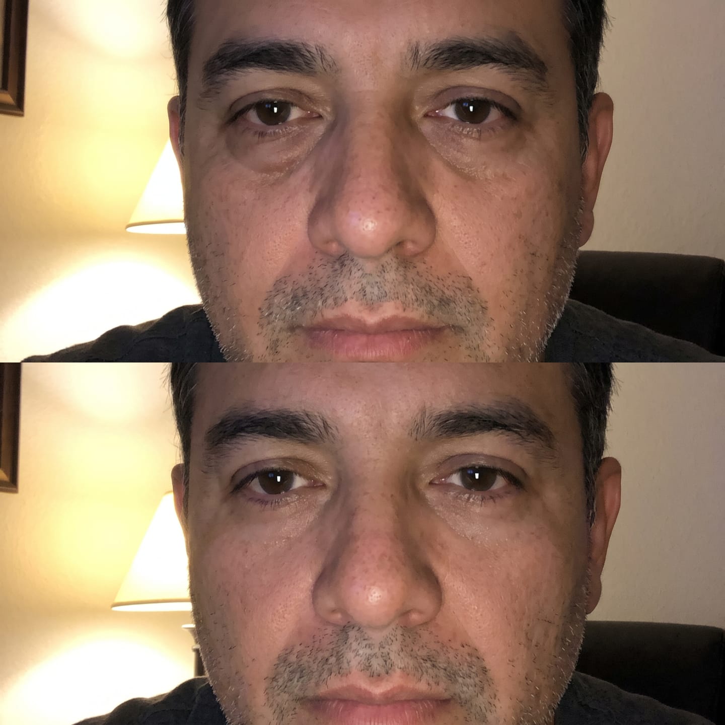 Customer photo review of Concele™ Instant Eye Firmer