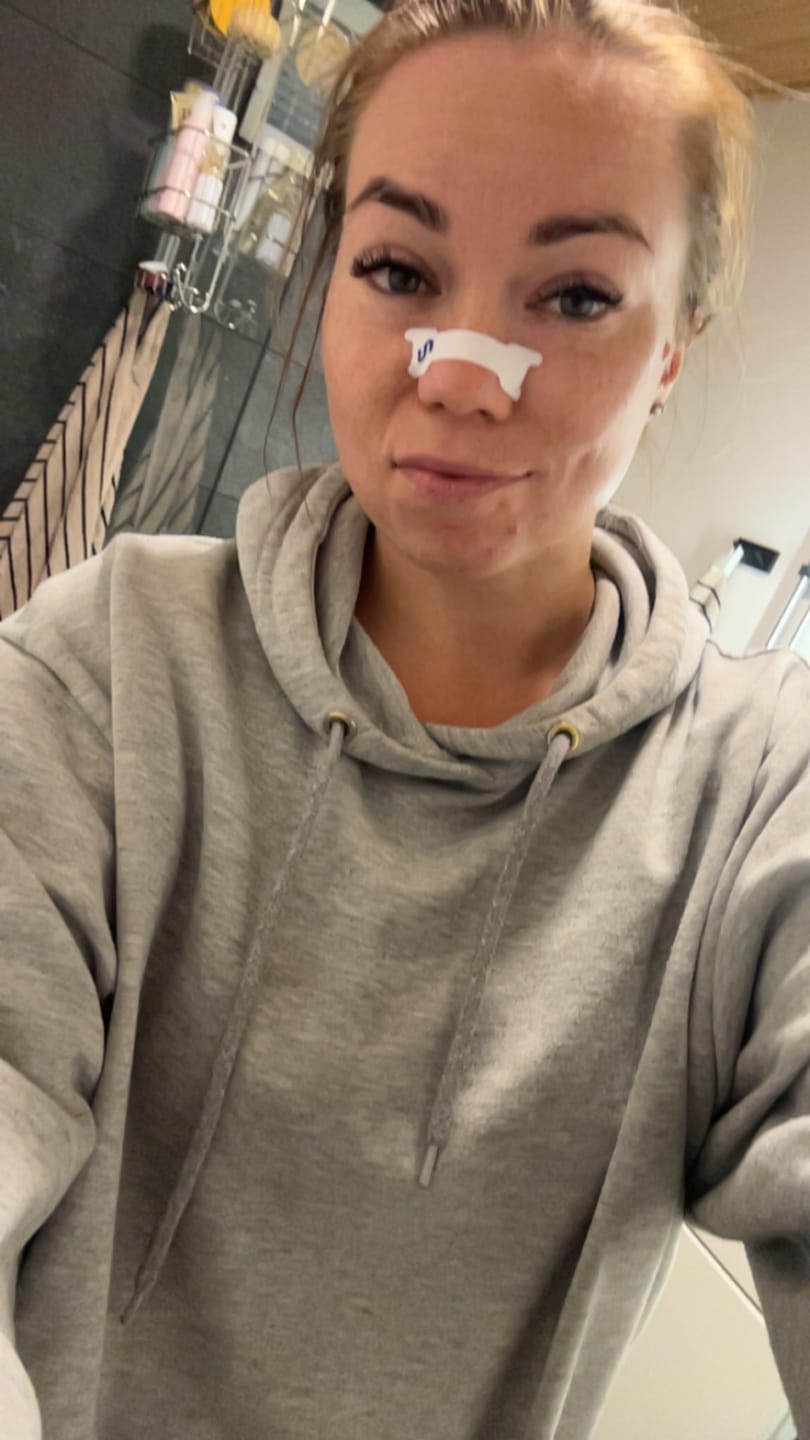 Customer photo review of Nuku Sleep Nasal Strips