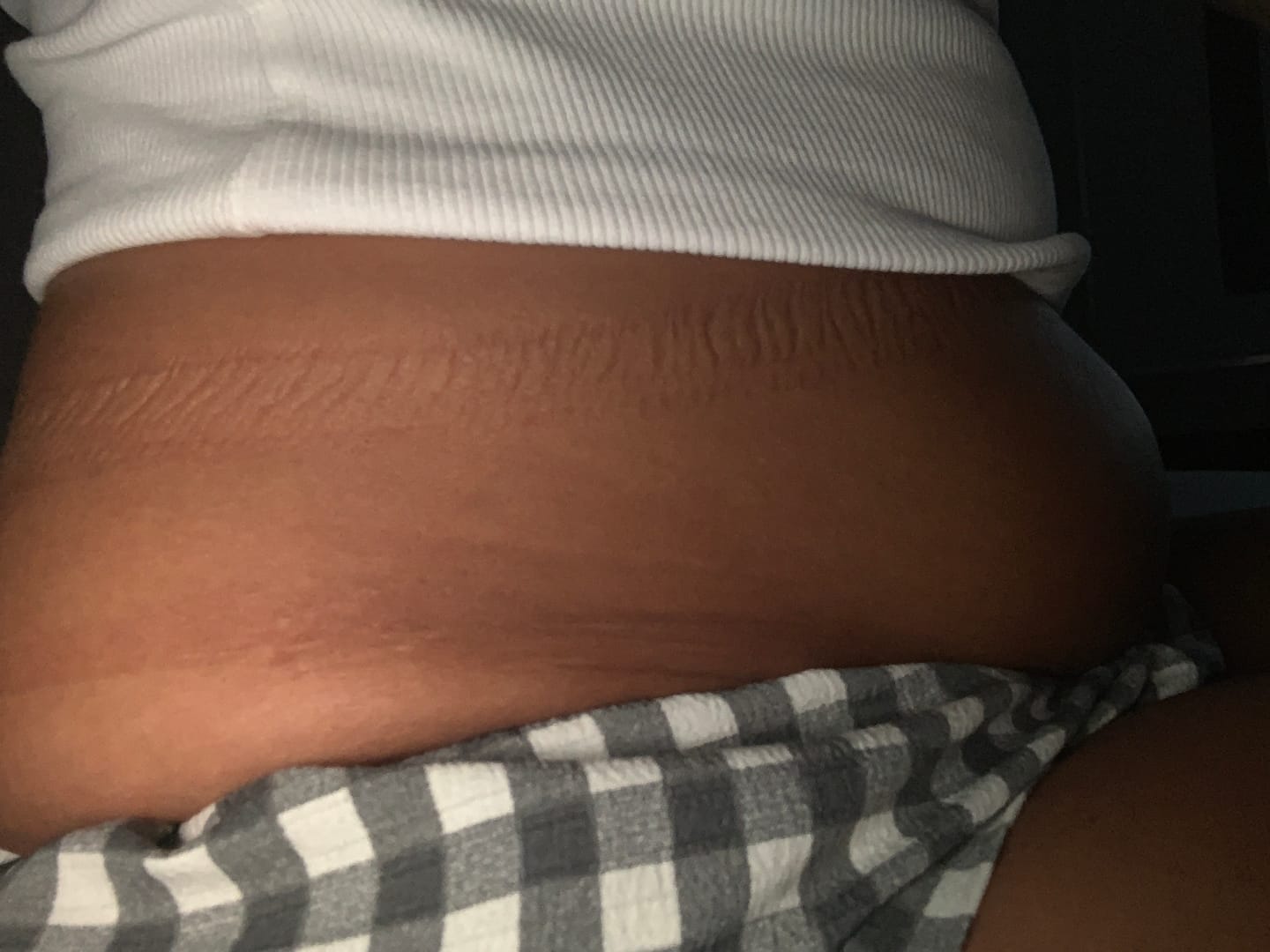 Customer photo review of Gélules Minceur