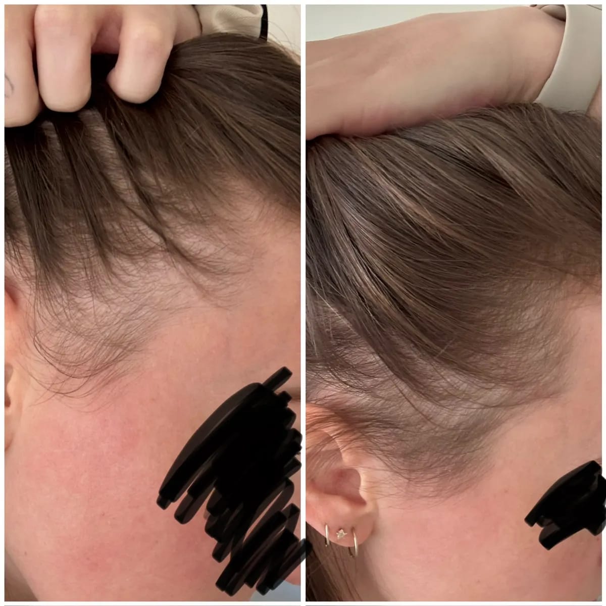 Customer photo review of Barra Coreana Revitalizante