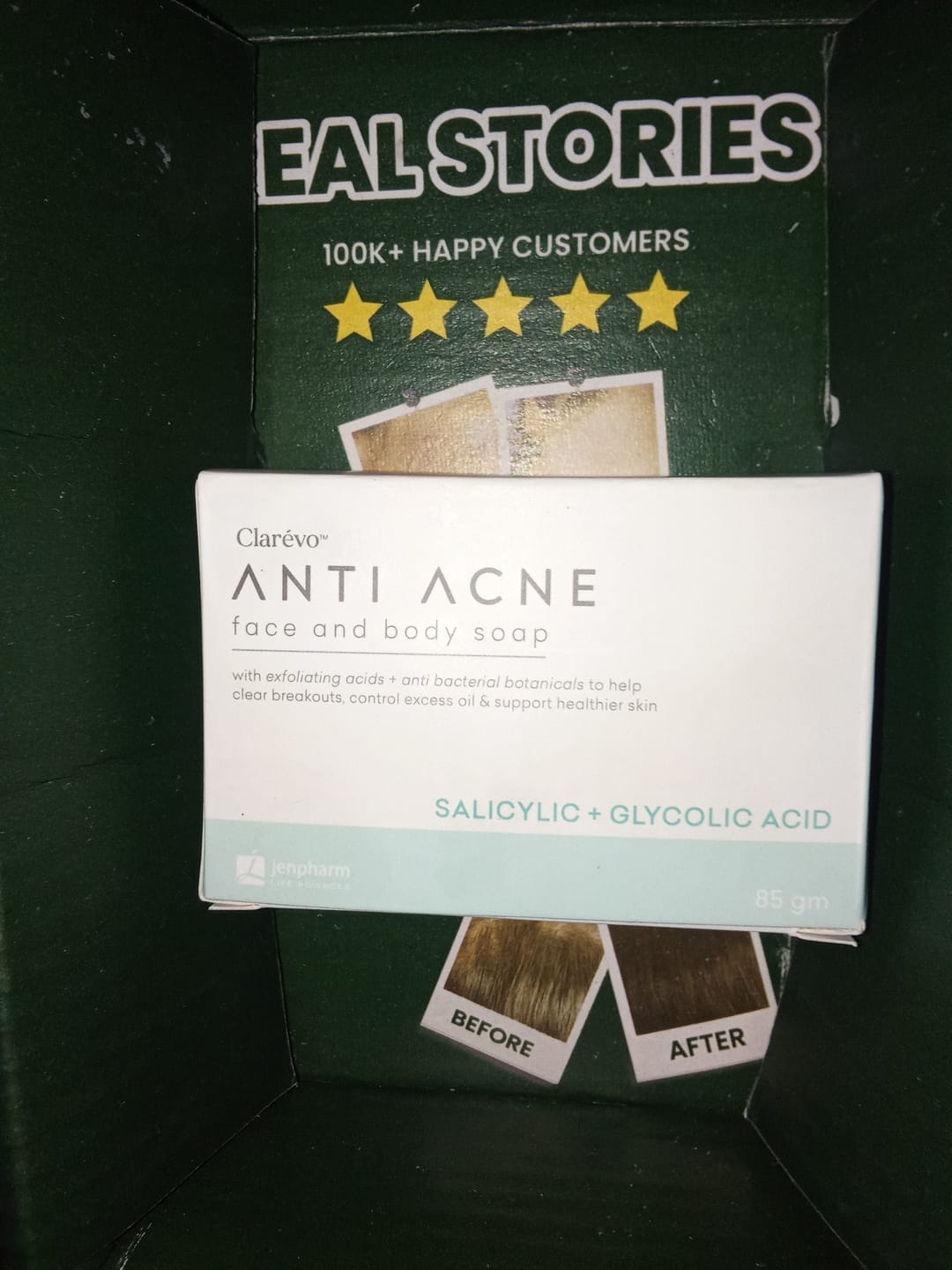 Customer photo review of Clarevo Anti Acne Soap
