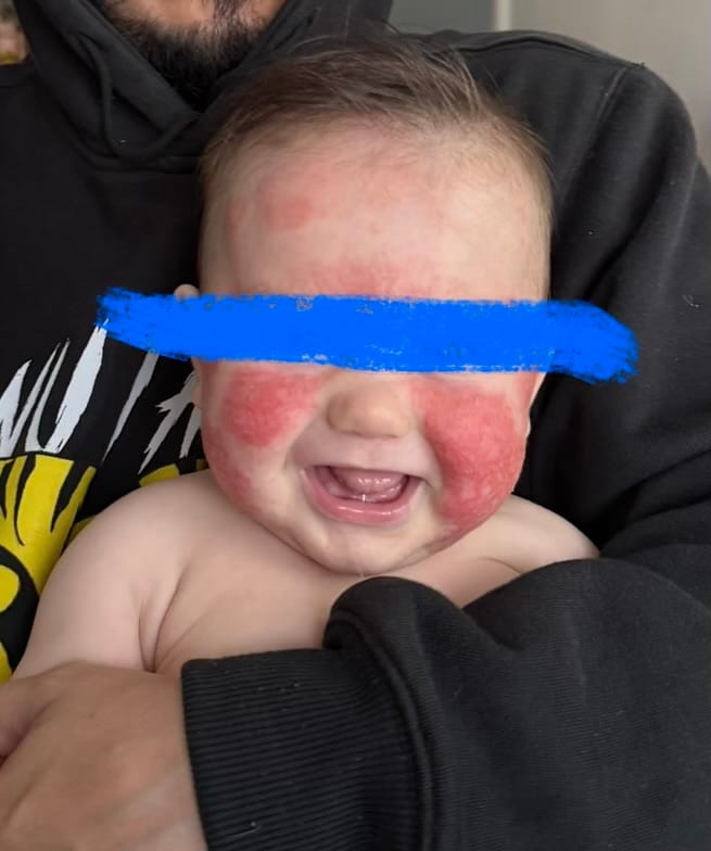 Customer photo review of HEALING SALVE