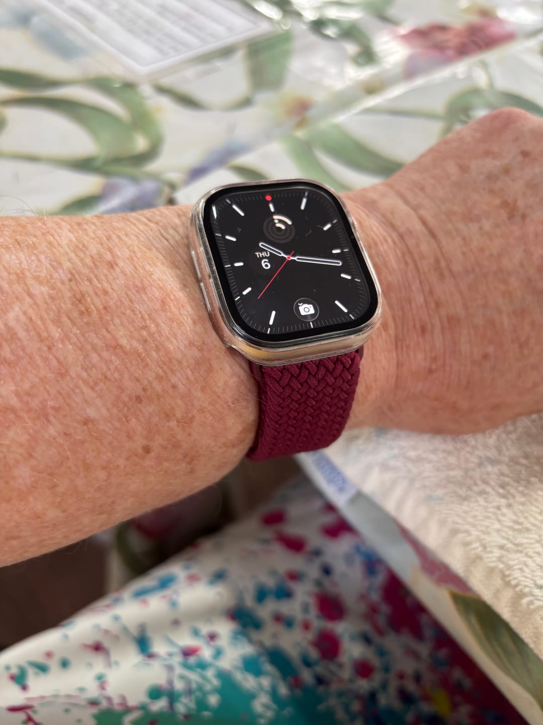 Customer photo review of FlexiFit™ Braided Magnetic Band - BUY 1 GET 1 FREE!