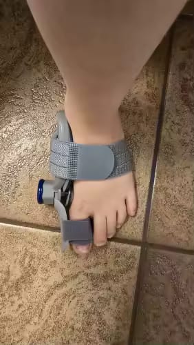 Customer photo review of HalluxAlign™