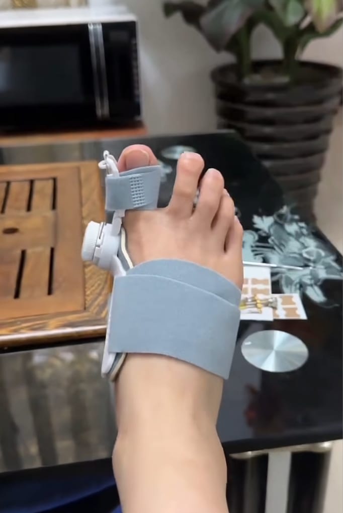 Customer photo review of HalluxAlign™