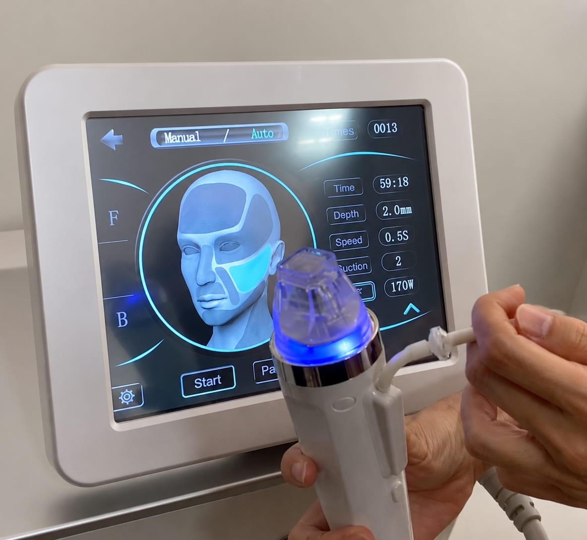 Customer photo review of RF Microneedling Machine Golden