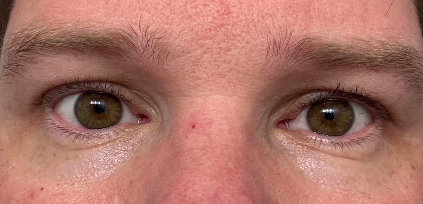 Customer photo review of Concele™ Instant Eye Firmer